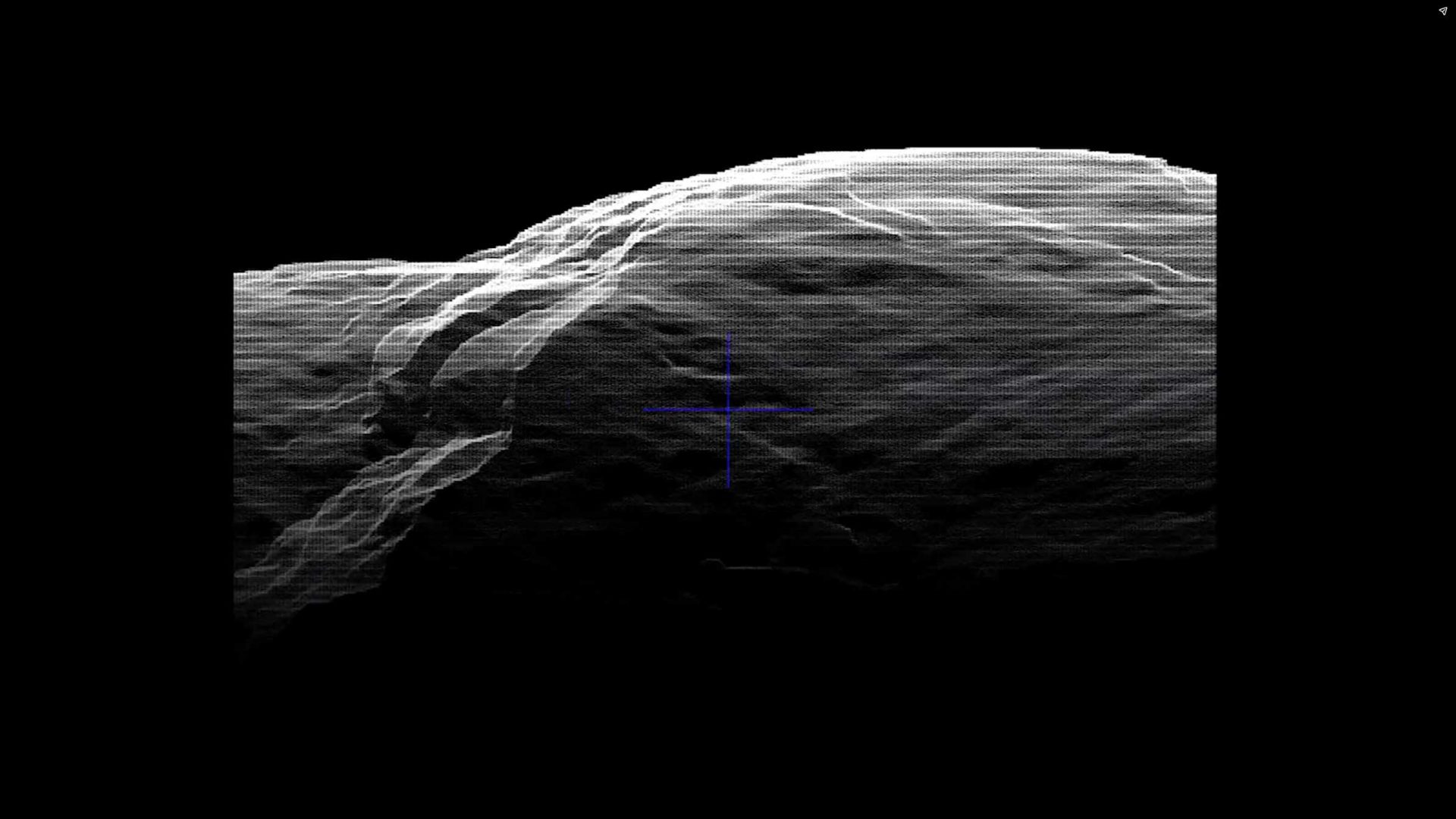 Ultrasound image showing a cross-sectional view of tissue with a blue crosshair marker centered, possibly indicating an area of interest for medical assessment. Black background reminiscent of visuals in a Bonobo music video like "Me And You. Frame from Stash Magazine article.
