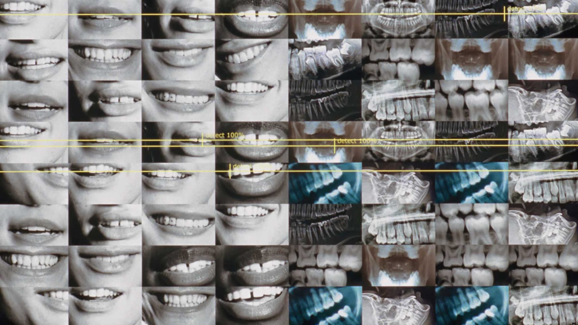 A collage of black-and-white and color images—captured with the clarity of a Dyson CameraJet—showing close-up smiles and dental X-rays, arranged in a grid pattern. Yellow horizontal lines run across the collage. Frame from Stash Magazine article.