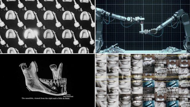 A collage of four images inspired by the Dyson-CameraJet-launch-ad-by-Love-Song-Will-Dohrn: dental molds, robotic arms operating, a diagram of a mandible, and a grid of smiling mouths with dental X-rays. Frame from Stash Magazine article.