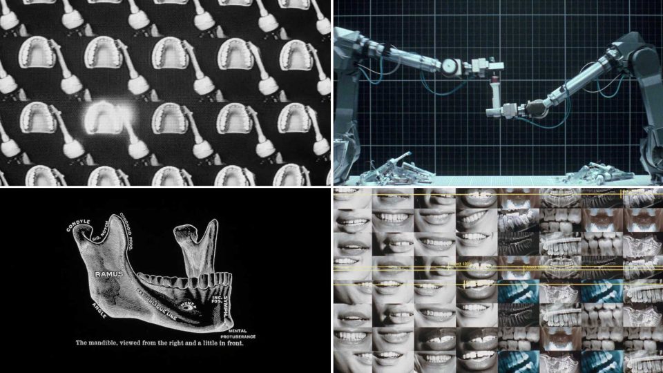 A collage of four images inspired by the Dyson-CameraJet-launch-ad-by-Love-Song-Will-Dohrn: dental molds, robotic arms operating, a diagram of a mandible, and a grid of smiling mouths with dental X-rays. Frame from Stash Magazine article.