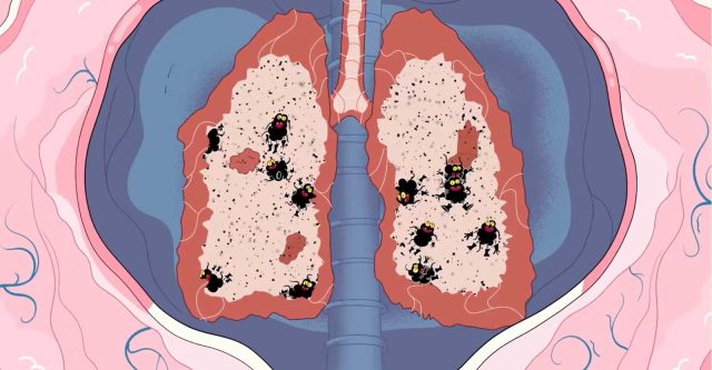 Kitchen And Jelly Take On Super Pollutants For The Climate And Clean
